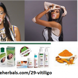 Naturally-Healing-of-Vitiligo