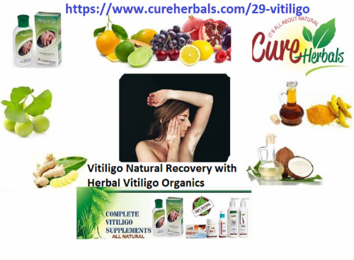 Recover-Vitiligo-with-Natural-Herbal-Remedies.png