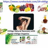 Recover-Vitiligo-with-Natural-Herbal-Remedies