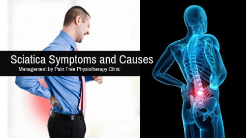 Sciatica-Symptoms-and-Causes.jpg