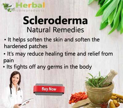 Scleroderma.jpg