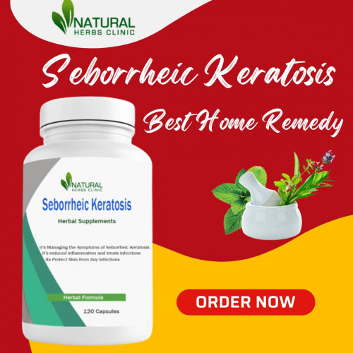 Natural Remedies for Seborrheic Keratosis can aid in reducing the swelling and irritation brought on by the condition. https://dailybusinesspost.com/seborrheic-keratosis-deal-the-condition-with-home-remedies/