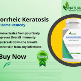 Seborrheic-Keratosis-and-How-to-Treat-it-with-Natural-Remedies