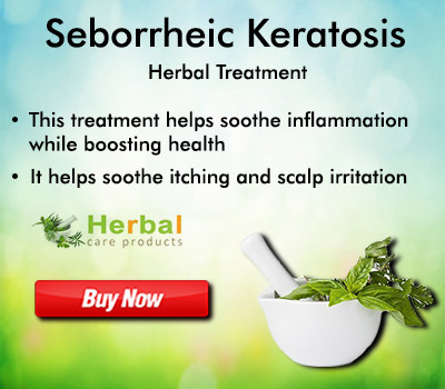 Seborrheic-Keratosis.jpg