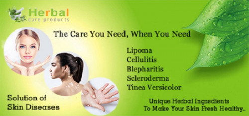 Natural Herbal Remedies for Health and Skin like Actinic Keratosis, Lipoma, Scleroderma, and Lichen Planus: Herbal Care Products solve these health and skin problems one by one.
https://www.herbal-care-products.com/blog/natural-home-remedies-for-health-and-skin/