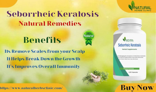 Information on Natural Treatments for Seborrheic Keratosis is provided on this page. Discover how to use natural treatments. https://resistancephl.com/skin-damage-with-seborrheic-keratosis-utilize-natural-treatments-to-get-relief/