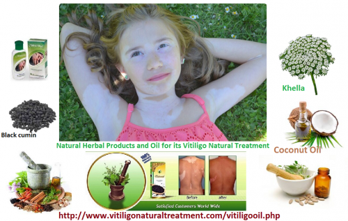 Skin-Disorder-Vitiligo-and-Natural-Herbal-Products-and-Oil-for-its-Natural-Treatment.png