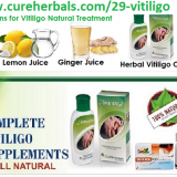 Skin-Disorder-Vitiligo-and-its-Natural-Herbal-Treatment-with-Red-Clay-and-other-Herbal