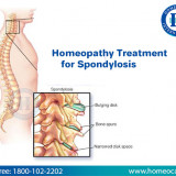 Spondylosishomeocare.in