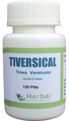 Tinea-Versicolor-Symptoms-Causes-and-Treatment-228x400b2706cc14972f70e.png