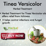 Tinea-Versicolor