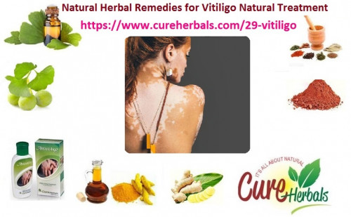 Try-Natural-Herbal-Ways-to-Get-Rid-of-Vitiligo-Naturally.jpg