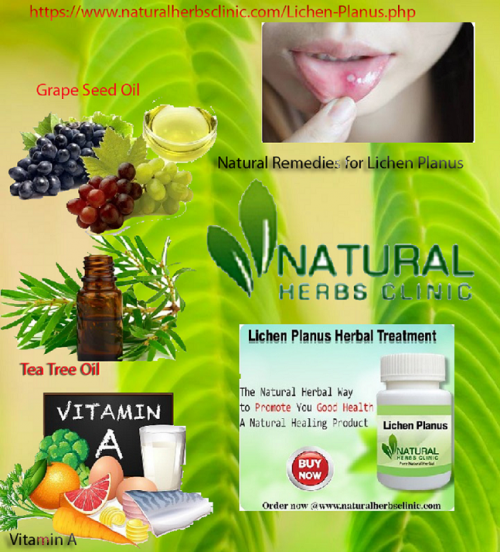 Grape seed oil is one of the ingredients used in Natural Remedies for Lichen Planus that helps reduce or prevent scarring. Like Babassu, it contains essential fatty acids. Like Functional Keratin, it has antioxidant activity... https://forum.linuxcnc.org/cb-profile/pluginclass/cbblogs?action=blogs&func=show&id=1911