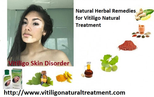 Vitiligo-Natural-Recovery141a94abb3dd921c.jpg