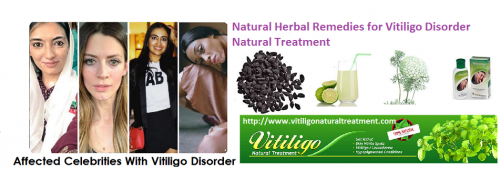 We offer vitiligo natural herbal oil for Vitiligo Natural Treatment and recovery. We have tendency to turn herb in distinctive form of oil that have particular feature of quick regimentation... https://padlet.com/vitiligo/vitiligonaturaltreatment