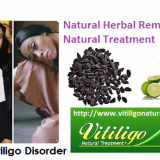 Vitiligo-Natural-Treatment-and-Recovery