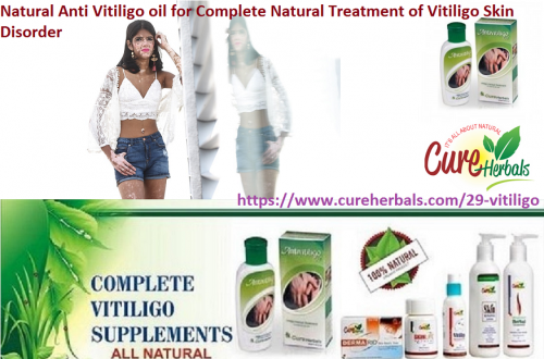 Vitiligo-Organics-Anti-Vitiligo-Herbal-Oil.png