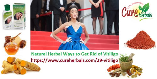 Vitiligo-Skin-Disorder-and-Natural-Herbal-Ways-to-Get-Rid-of-It.png