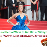 Vitiligo-Skin-Disorder-and-Natural-Herbal-Ways-to-Get-Rid-of-It