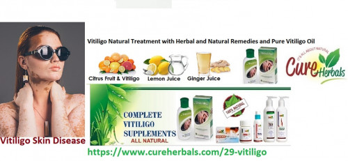 Vitiligo-and-its-Treatment-with-Herbal-and-Natural-Remedies-and-Pure-Vitiligo-Oil.jpg