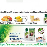 Vitiligo-and-its-Treatment-with-Herbal-and-Natural-Remedies-and-Pure-Vitiligo-Oil