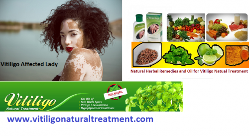 Vitiligo-its-Appearance-and-treatments-with-Natural-Herbs-and-Pure-Herbal-Vitiligo-Oil.png