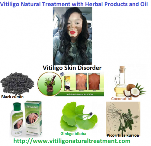 Vitiligo-its-Relation-to-other-Disease-and-its-Treatment-with-Natural-Herbal-Products-and-Oil.png