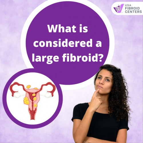 What-is-considered-a-large-fibroid.jpg