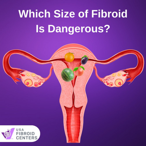 Which-Size-of-Fibroid-Is-dangerours.jpg