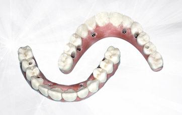 all-on-4-6-dental-implant-dentures-schenectady-dentist.jpg