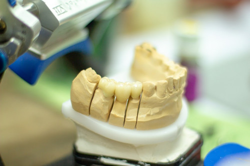 dentists-near-me-that-accept-delta-dental.jpg