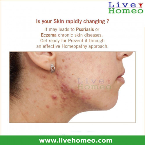 homeopathy-treatment-for-skin-problems.jpg