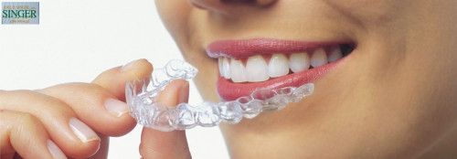 invisalign769d241438ce8a43.jpg