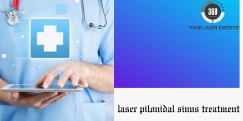 The best treatment for pilonidal sinus, despite the fact that there are several options, is laser treatment.
https://laser360clinic.com/what-makes-laser-treatment-best-for-treating-pilonidal-sinus/