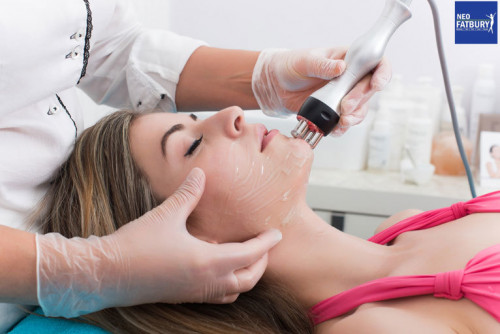 laser therapy for acne (1)