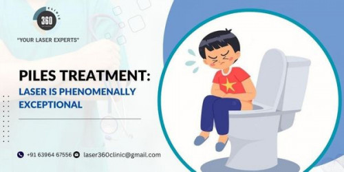 Laser360clinic is dedicated to serving its patients by offering them the best piles laser treatment cost at affordable costs. So, visit soon.
https://laser360clinic.com/piles-treatment-laser-is-phenomenally-exceptional/