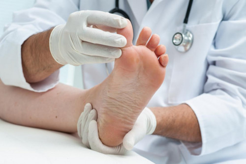 podiatrist-looking-at-athletes-foot.jpg